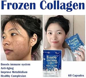 Frozen Collagen 2in1 Whitening X10