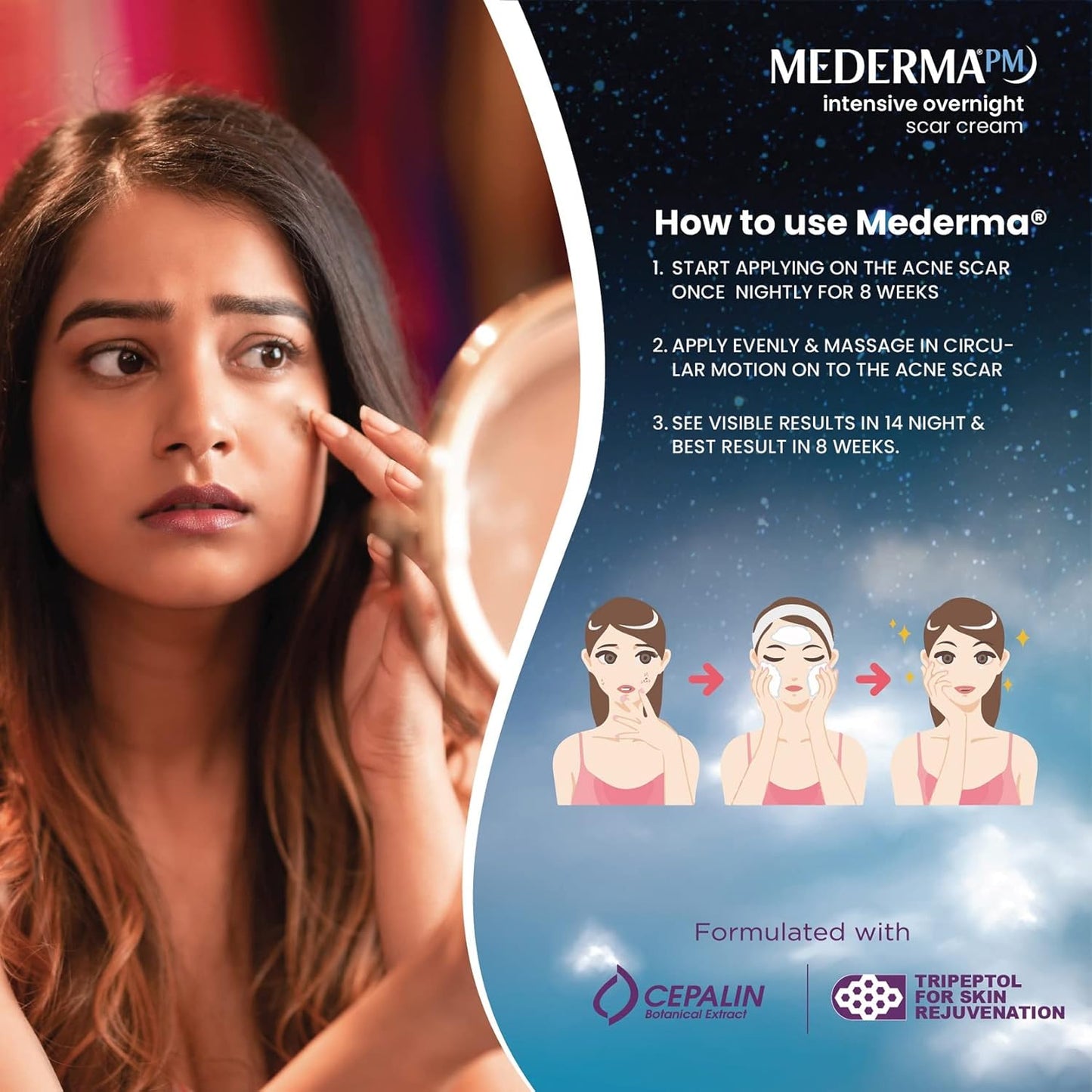 Mederma PM Intensive Overnight Scar Cream: Pack of 2, 30 g each