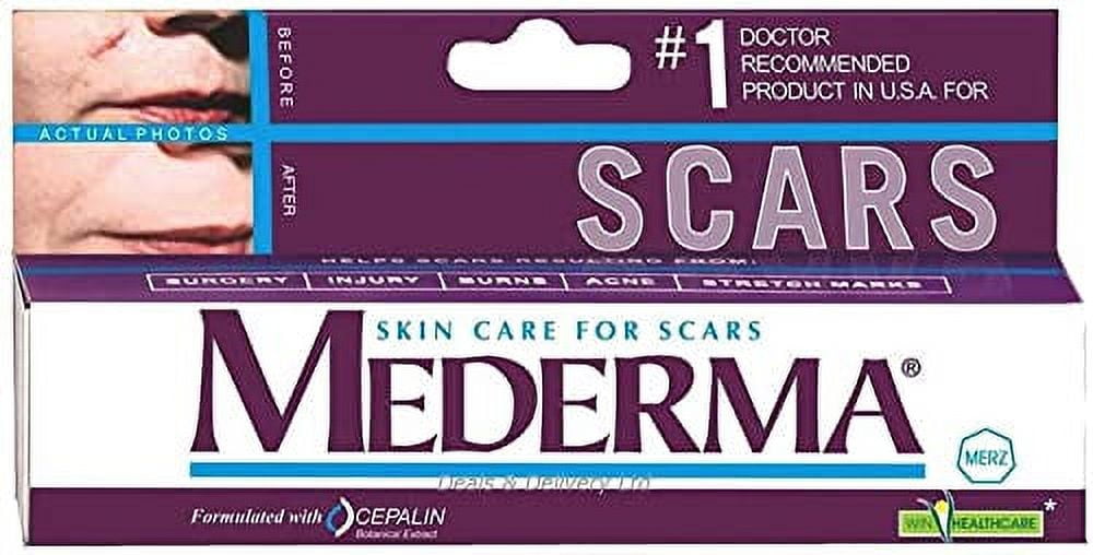 Mederma SkinCare (Helps Scars -Surgery, Injury, Burns, Acne,Stretch marks)