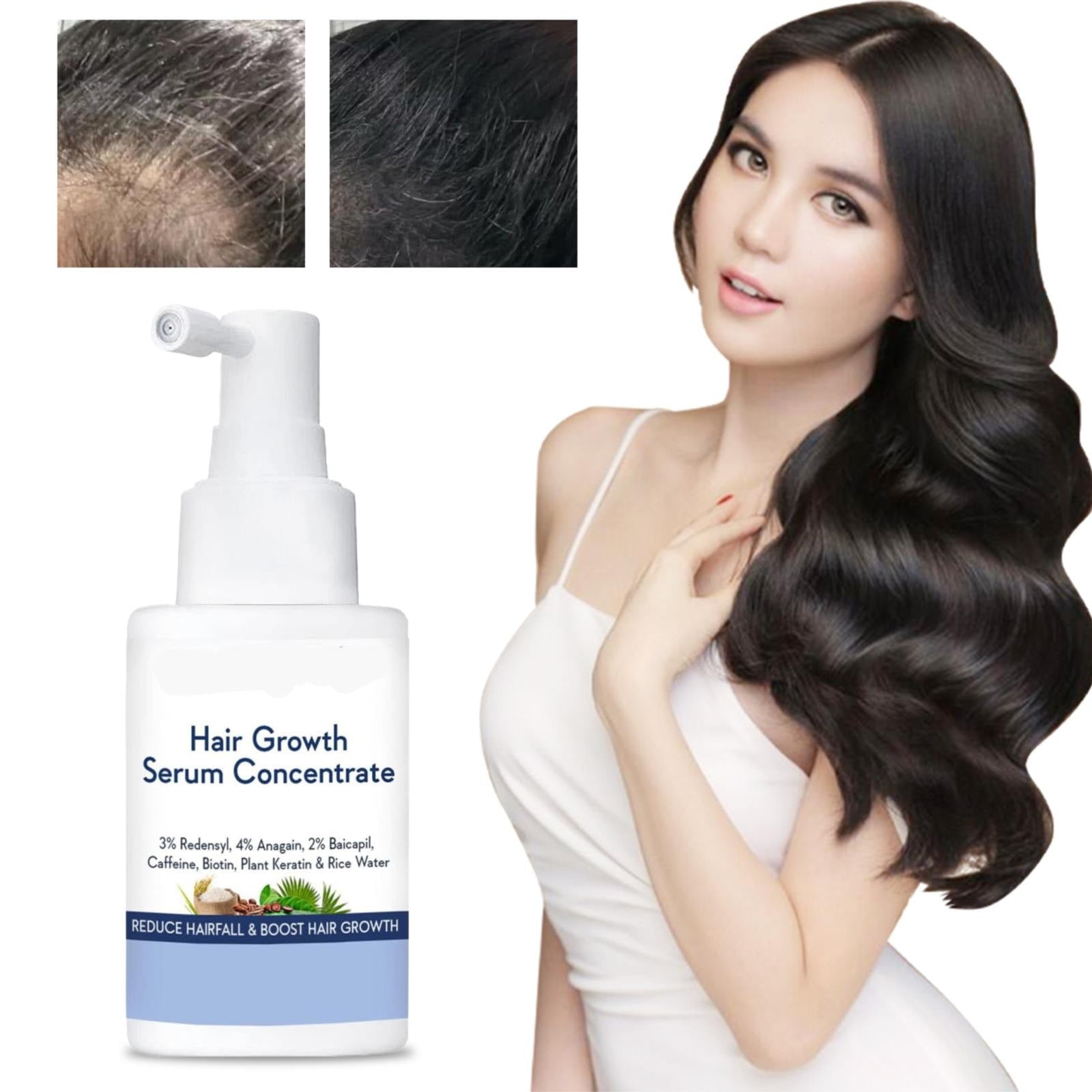 Wish-Care Hair Growth Serum Concentrate with Plant Keratin & Rice Water- 30ml