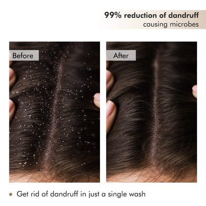 mCaffeine Coffee Scalp Scrub: Anti Dandruff, 250 g