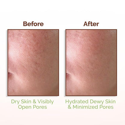 Mamaearth Rice Water Dewy Face Toner Rice Water & 4% Niacinamide, 150 ml