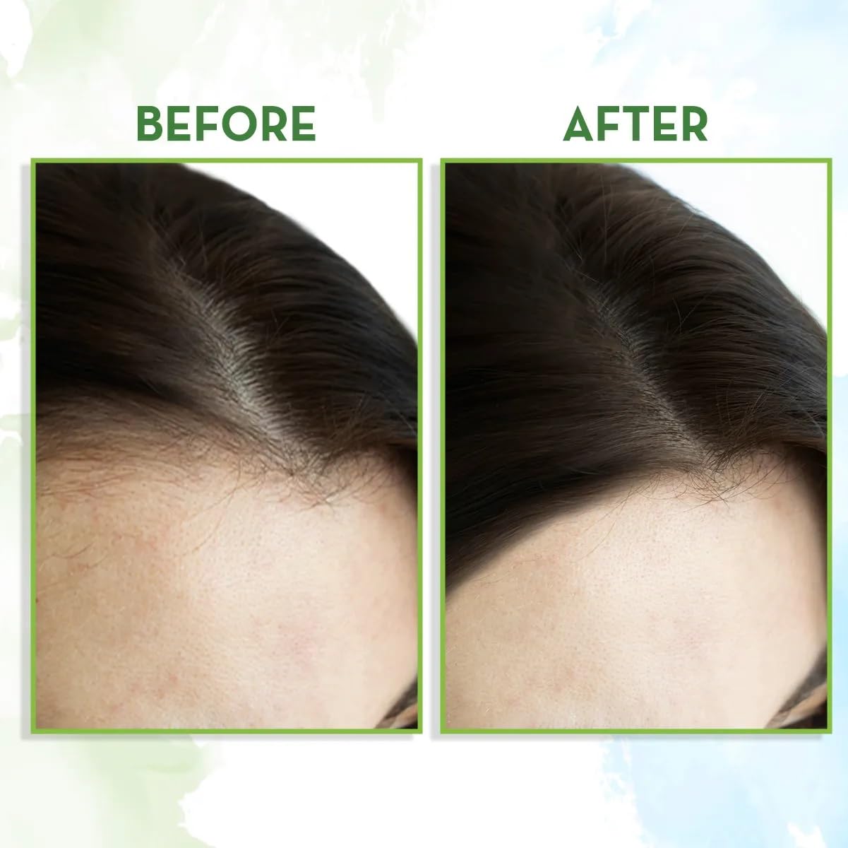 Mamaearth Rosemary Essential Oil: Hair Fall Control, 15 ml