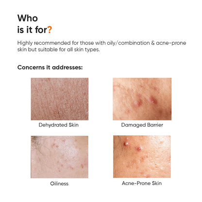 Minimalist 10% Vitamin B5 Gel Face Moisturizer For Oily Acne Prone Skin | Oil-free | Fast Absorbing Lightweight Winter Cream | 50 g