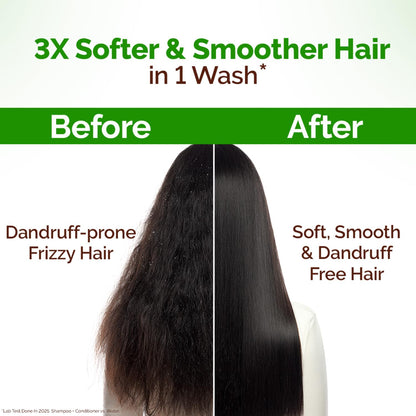 Mamaearth Lemon Anti-Dandruff Conditioner With Lemon & Ginger For Soft & Smooth For All Types Hair 250 Ml