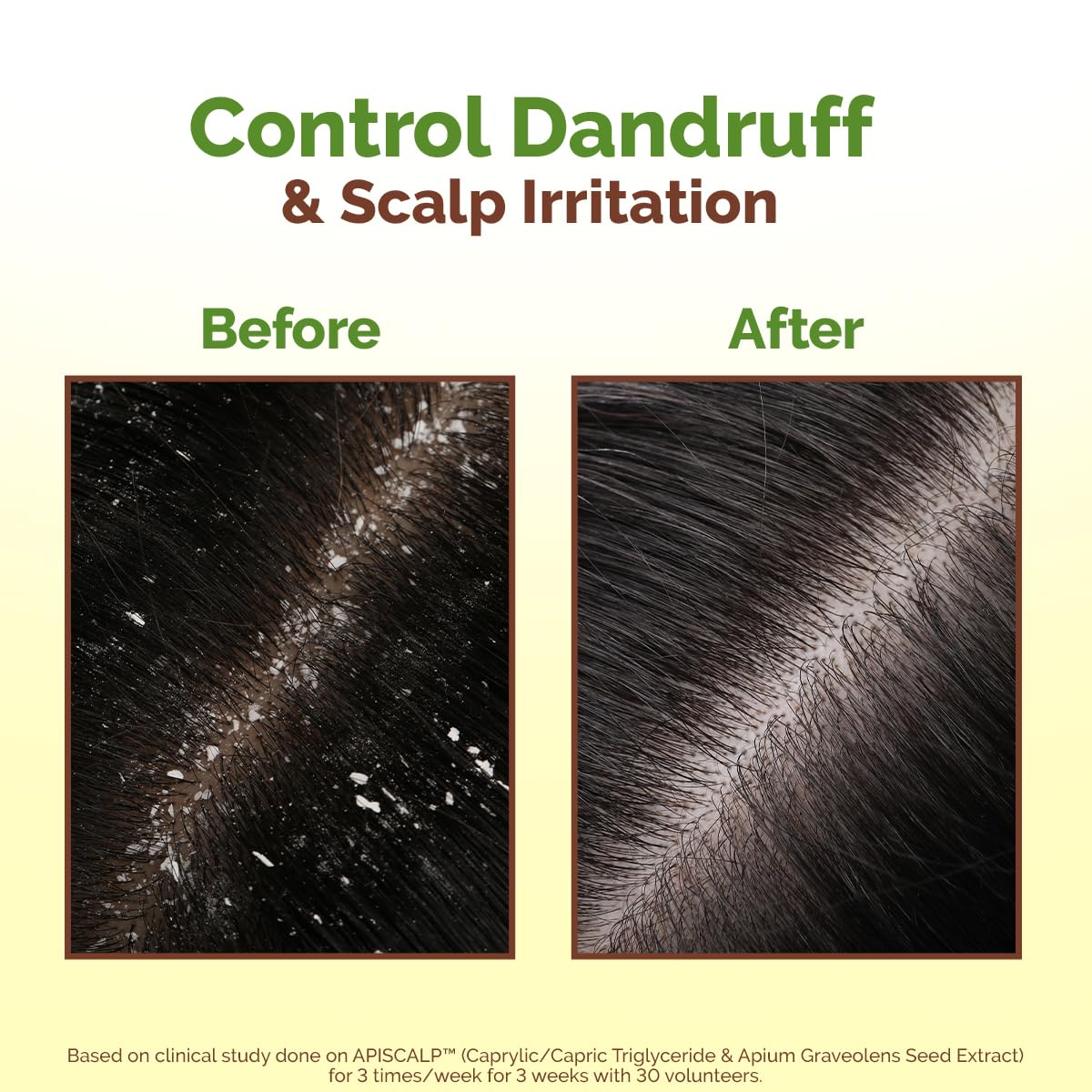 Mamaearth Lemon Anti-Dandruff HairOil for Flaky Scalp 100ml