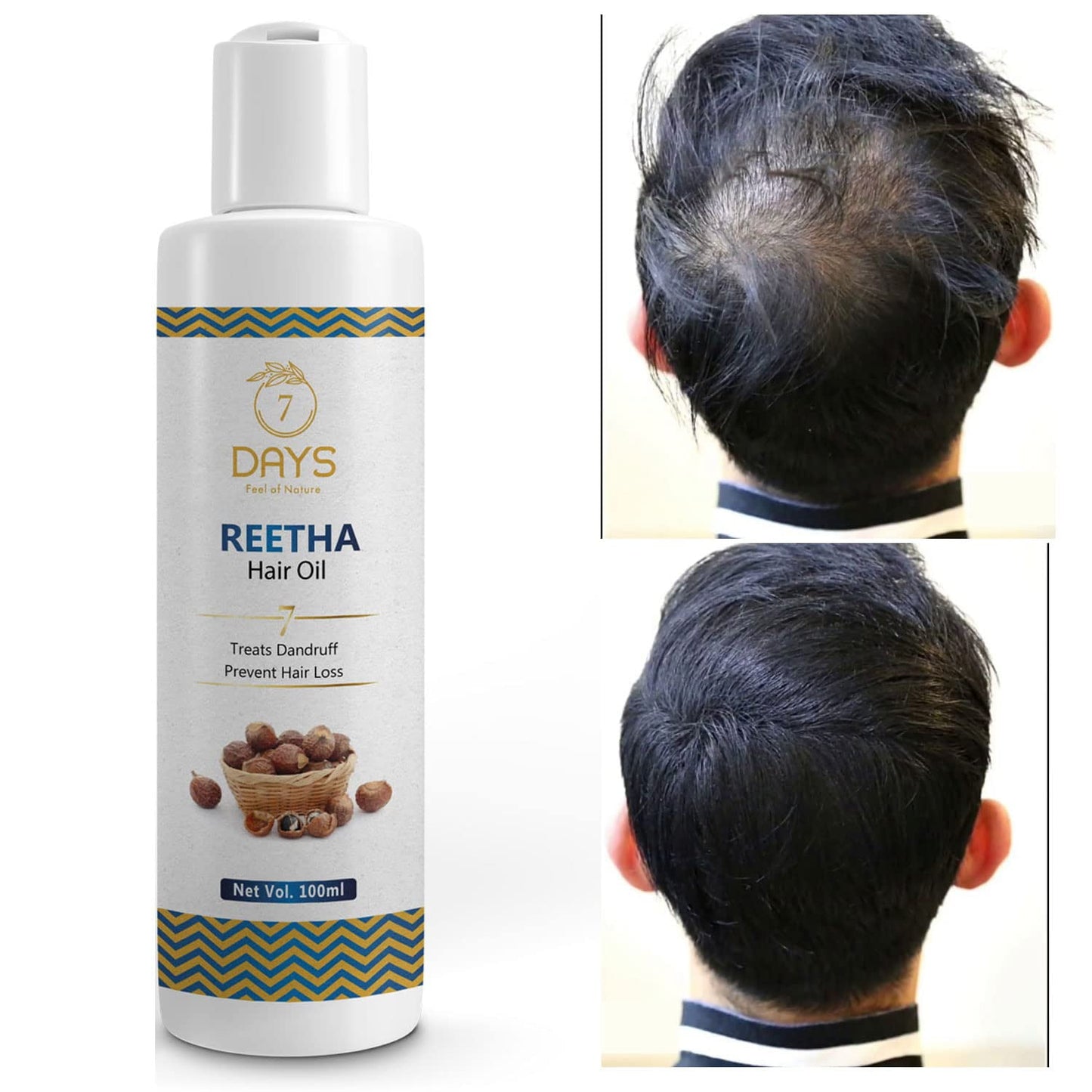7 Days Reetha Onion Shikakai Bhringraj Amla HairOil For Men & Women, 100% Natural Oils And