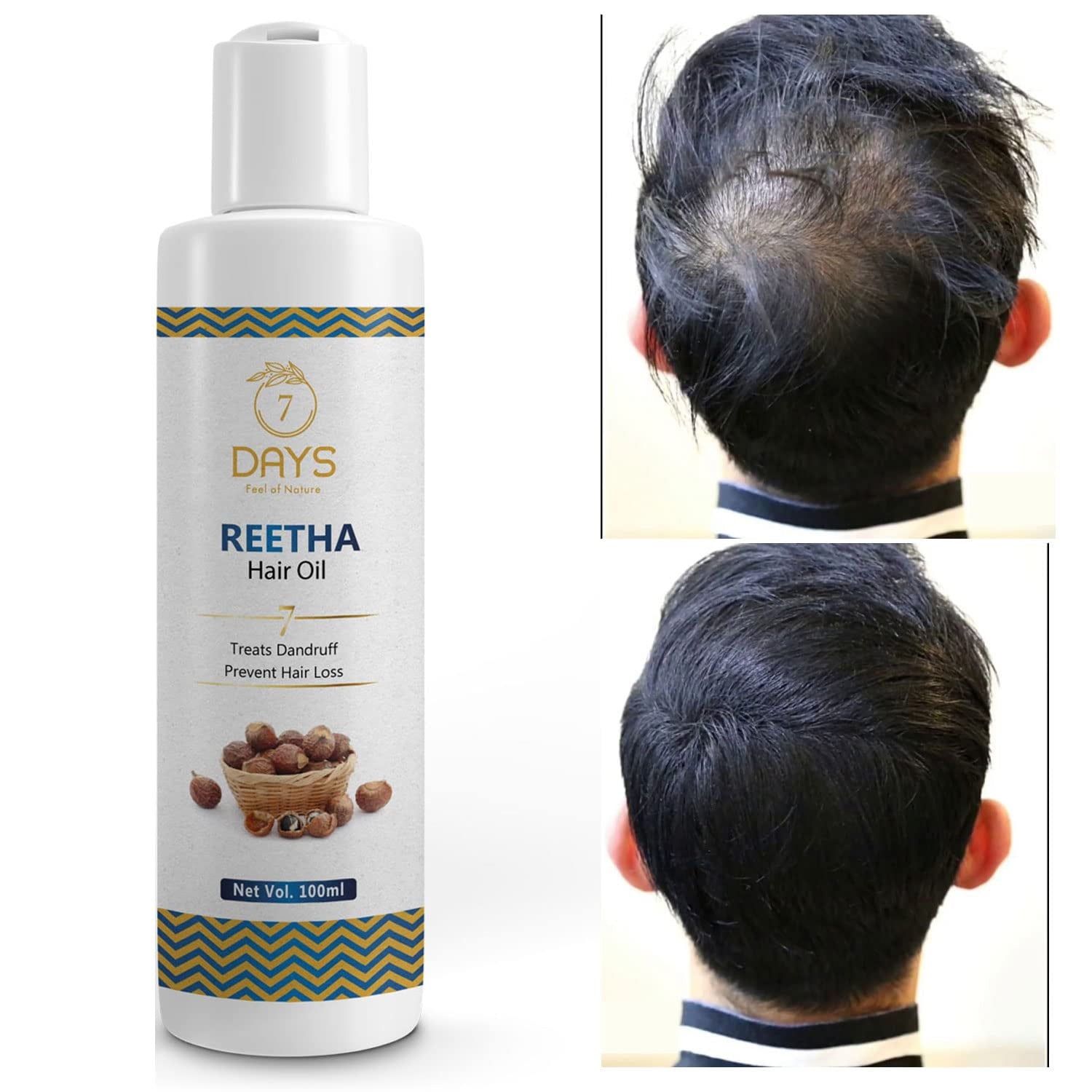 7 Days Reetha Onion Shikakai Bhringraj Amla HairOil For Men & Women, 100% Natural Oils And